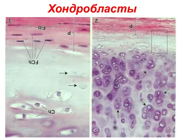 Хондробласты