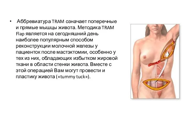Аббревиатура TRAM означает поперечные и прямые мышцы живота. Методика TRAM