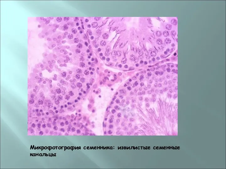 Микрофотография семенника: извилистые семенные канальцы