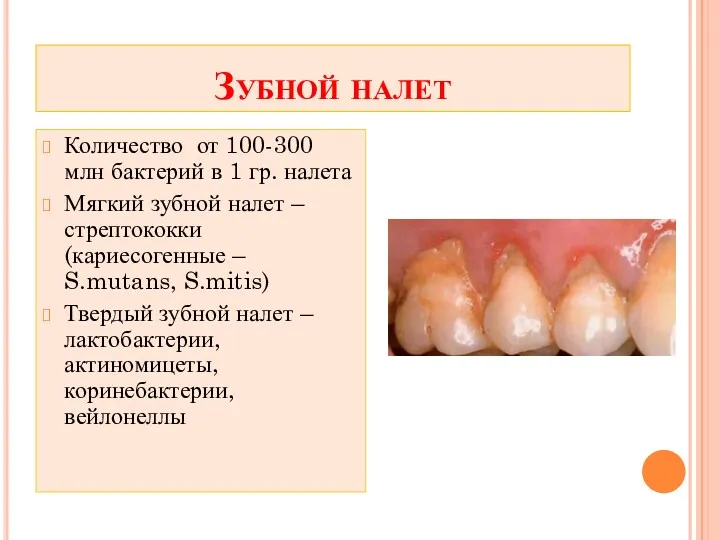 Зубной налет Количество от 100-300 млн бактерий в 1 гр.