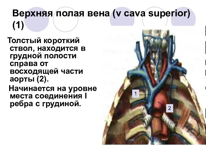 Верхняя полая вена (v cava superior) (1) Толстый короткий ствол,