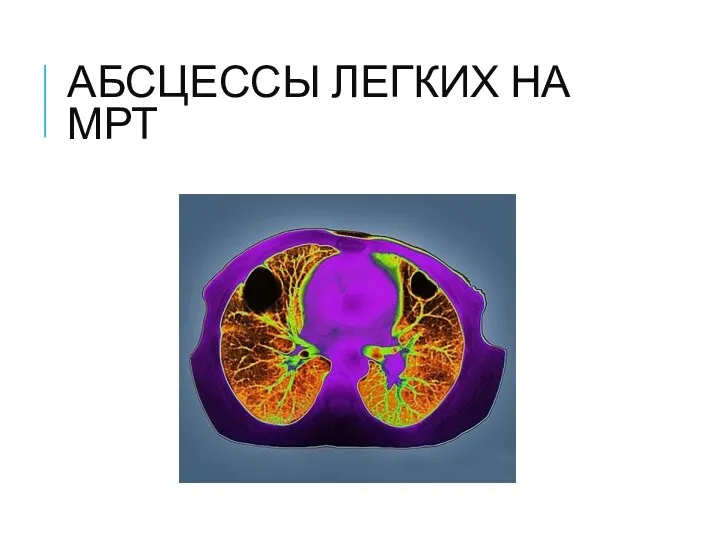 АБСЦЕССЫ ЛЕГКИХ НА МРТ