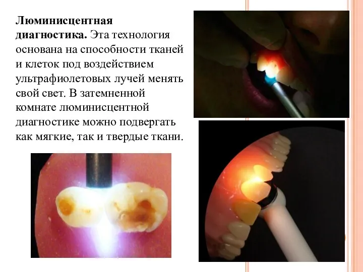 Люминисцентная диагностика. Эта технология основана на способности тканей и клеток