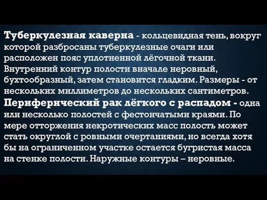 Туберкулезная каверна - кольцевидная тень, вокруг которой разбросаны туберкулезные очаги