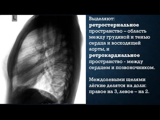 Выделяют: ретростернальное пространство – область между грудиной и тенью сердца