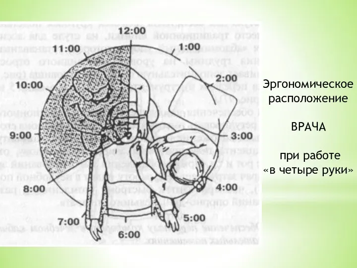 Эргономическое расположение ВРАЧА при работе «в четыре руки»