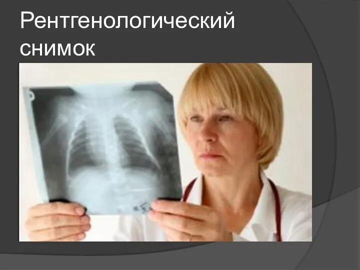 Рентгенологический снимок