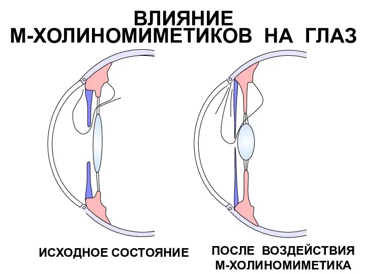 ПОСЛЕ ВОЗДЕЙСТВИЯ М-ХОЛИНОМИМЕТИКА ВЛИЯНИЕ М-ХОЛИНОМИМЕТИКОВ НА ГЛАЗ ИСХОДНОЕ СОСТОЯНИЕ