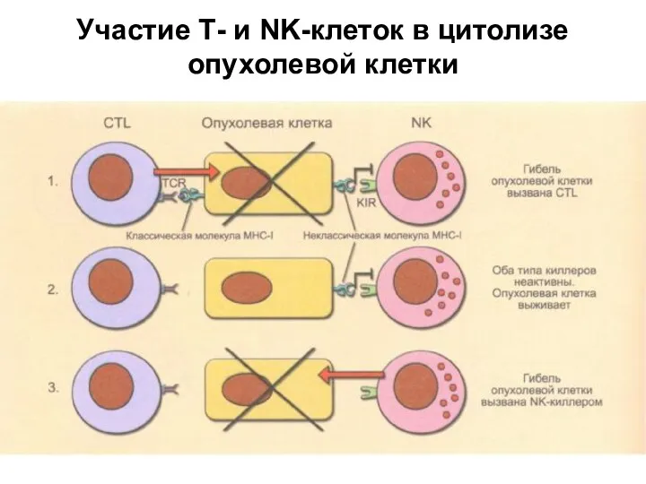 Участие Т- и NK-клеток в цитолизе опухолевой клетки