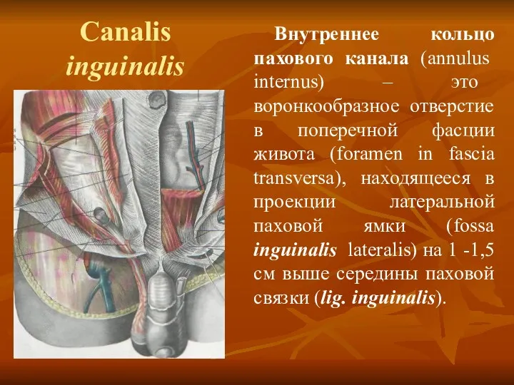 Canalis inguinalis Внутреннее кольцо пахового канала (annulus internus) – это воронкообразное отверстие в