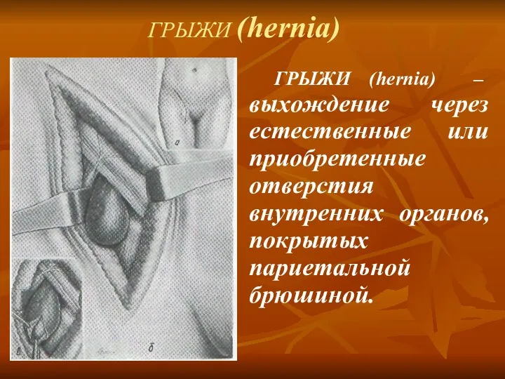 ГРЫЖИ (hernia) ГРЫЖИ (hernia) – выхождение через естественные или приобретенные отверстия внутренних органов, покрытых париетальной брюшиной.