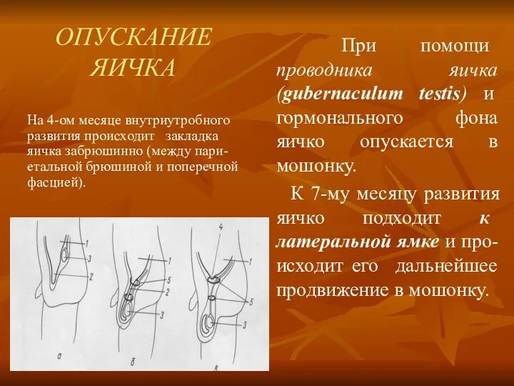 ОПУСКАНИЕ ЯИЧКА На 4-ом месяце внутриутробного развития происходит закладка яичка забрюшинно (между пари-етальной