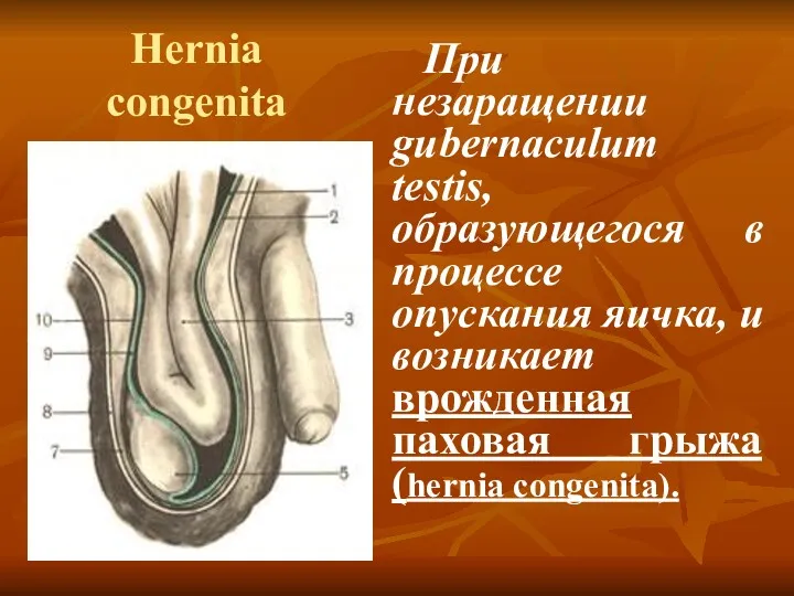 Hernia congenita При незаращении gubernaculum testis, образующегося в процессе опускания яичка, и возникает