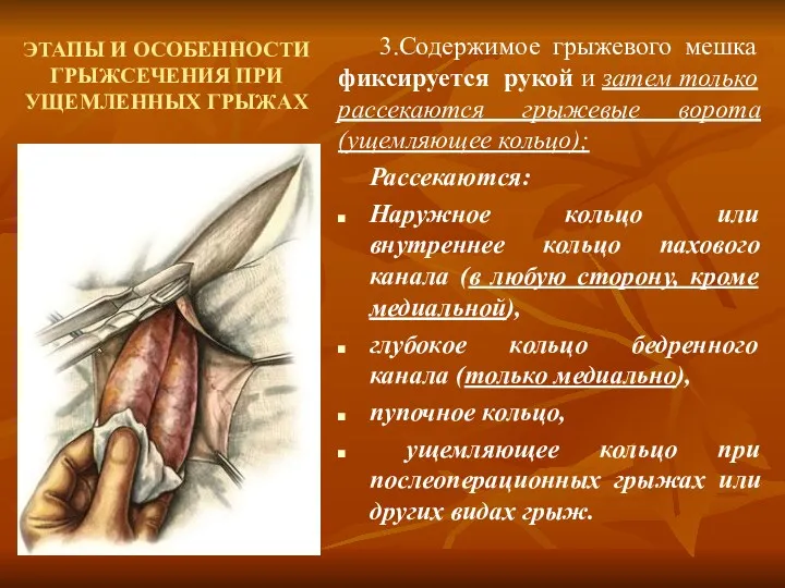 ЭТАПЫ И ОСОБЕННОСТИ ГРЫЖСЕЧЕНИЯ ПРИ УЩЕМЛЕННЫХ ГРЫЖАХ 3.Содержимое грыжевого мешка