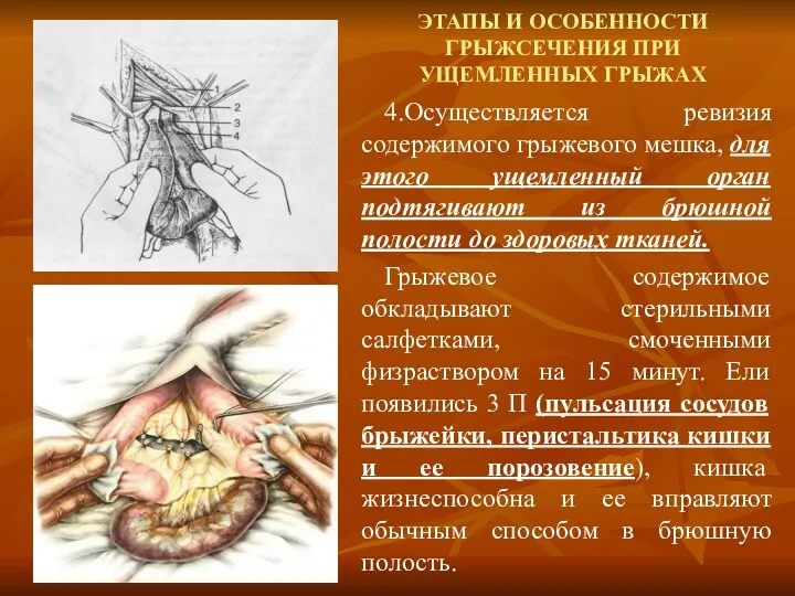 ЭТАПЫ И ОСОБЕННОСТИ ГРЫЖСЕЧЕНИЯ ПРИ УЩЕМЛЕННЫХ ГРЫЖАХ 4.Осуществляется ревизия содержимого