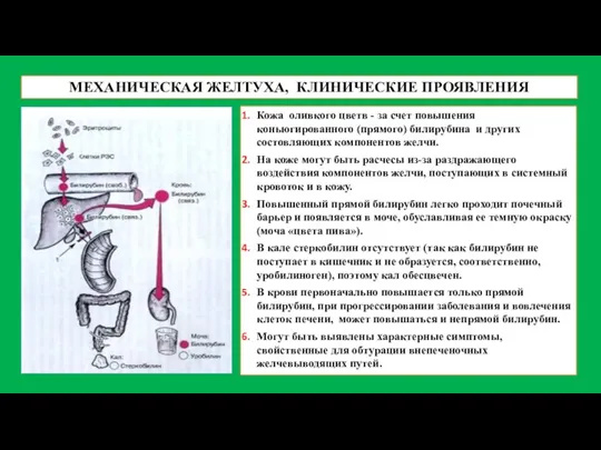 МЕХАНИЧЕСКАЯ ЖЕЛТУХА, КЛИНИЧЕСКИЕ ПРОЯВЛЕНИЯ Кожа оливкого цветв - за счет