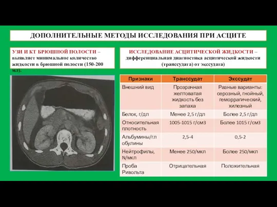 ДОПОЛНИТЕЛЬНЫЕ МЕТОДЫ ИССЛЕДОВАНИЯ ПРИ АСЦИТЕ УЗИ И КТ БРЮШНОЙ ПОЛОСТИ