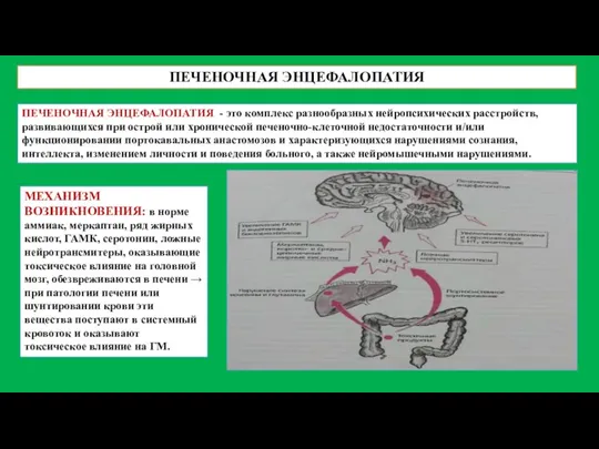 ПЕЧЕНОЧНАЯ ЭНЦЕФАЛОПАТИЯ ПЕЧЕНОЧНАЯ ЭНЦЕФАЛОПАТИЯ - это комплекс разнообразных нейропсихических расстройств,