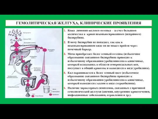 ГЕМОЛИТИЧЕСКАЯ ЖЕЛТУХА, КЛИНИЧЕСКИЕ ПРОЯВЛЕНИЯ Кожа лимонно-желтого оттенка – за счет