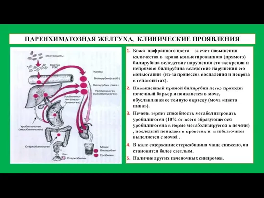 ПАРЕНХИМАТОЗНАЯ ЖЕЛТУХА, КЛИНИЧЕСКИЕ ПРОЯВЛЕНИЯ Кожа шафранного цвета – за счет