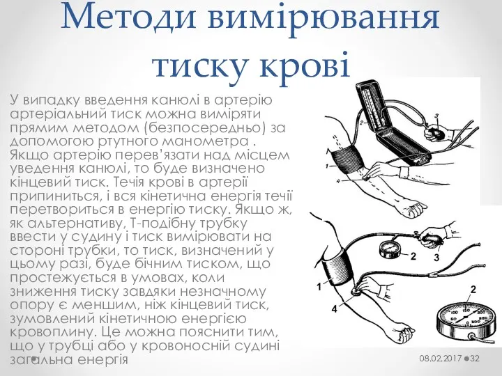 Методи вимірювання тиску крові У випадку введення канюлі в артерію