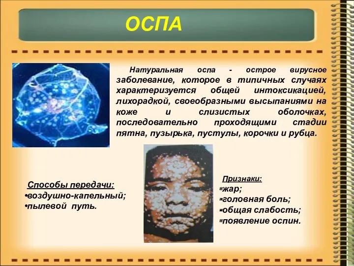 Натуральная оспа - острое вирусное заболевание, которое в типичных случаях