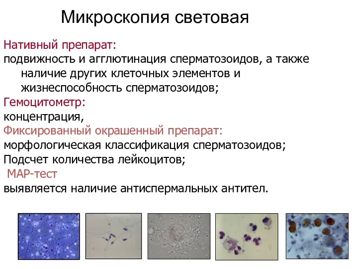 Микроскопия световая Нативный препарат: подвижность и агглютинация сперматозоидов, а также