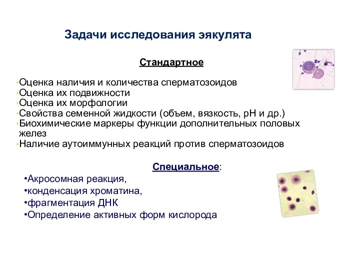 Задачи исследования эякулята Стандартное Оценка наличия и количества сперматозоидов Оценка