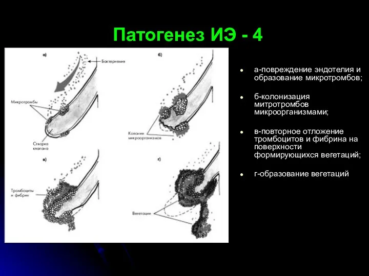 Патогенез ИЭ - 4 а-повреждение эндотелия и образование микротромбов; б-колонизация