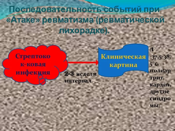 Последовательность событий при «Атаке» ревматизма (ревматической лихорадке). Стрептокок-ковая инфекция Клиническая