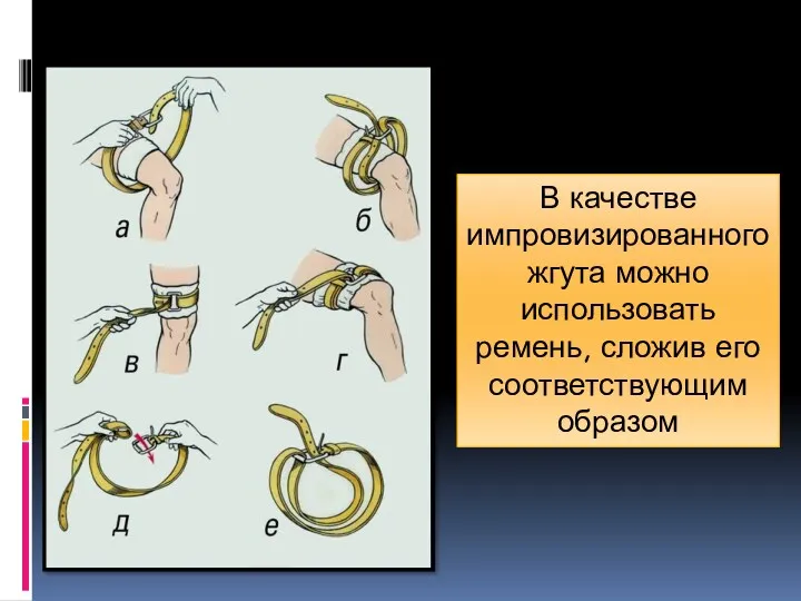 В качестве импровизированного жгута можно использовать ремень, сложив его соответствующим образом