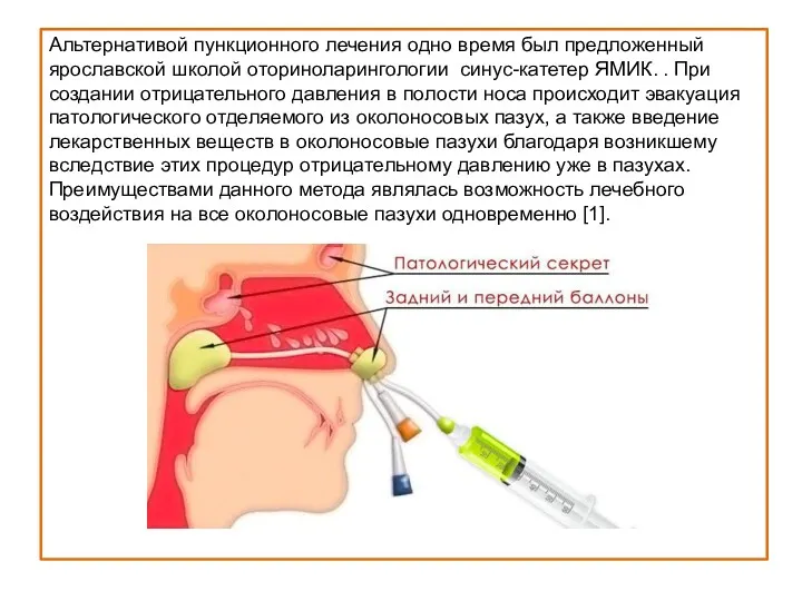 Альтернативой пункционного лечения одно время был предложенный ярославской школой оториноларингологии