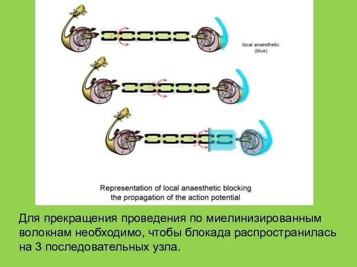 Для прекращения проведения по миелинизированным волокнам необходимо, чтобы блокада распространилась на 3 последовательных узла.