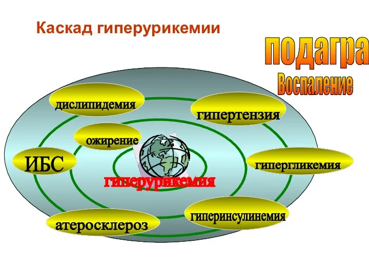 подагра гипергликемия гипертензия гиперинсулинемия дислипидемия ожирение ИБС атеросклероз гиперурикемия Воспаление Каскад гиперурикемии