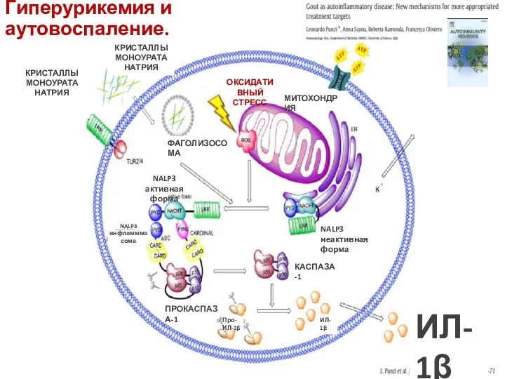 Гиперурикемия и аутовоспаление. ФАГОЛИЗОСОМА КРИСТАЛЛЫ МОНОУРАТА НАТРИЯ МИТОХОНДРИЯ ОКСИДАТИВНЫЙ СТРЕСС