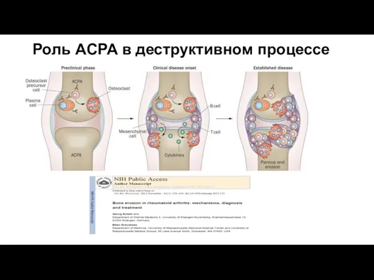 Роль ACPA в деструктивном процессе