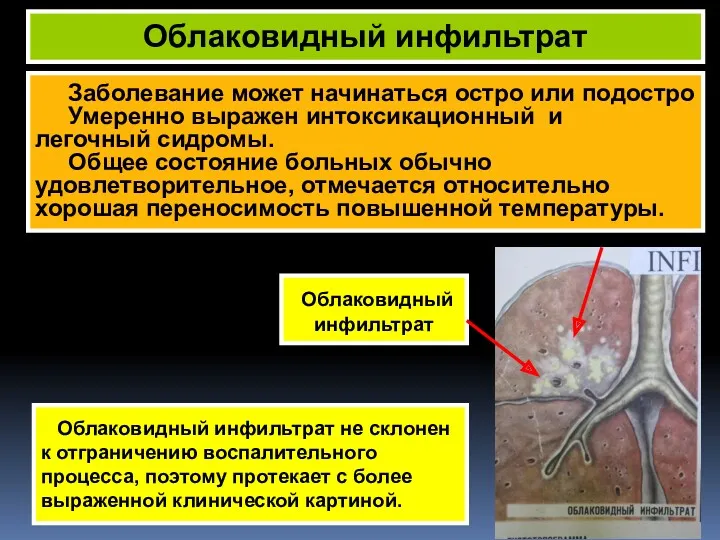 Заболевание может начинаться остро или подостро Умеренно выражен интоксикационный и