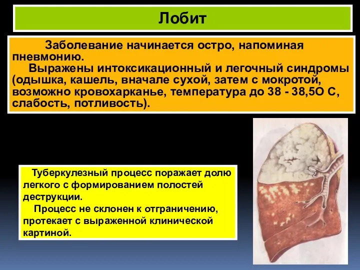 Заболевание начинается остро, напоминая пневмонию. Выражены интоксикационный и легочный синдромы