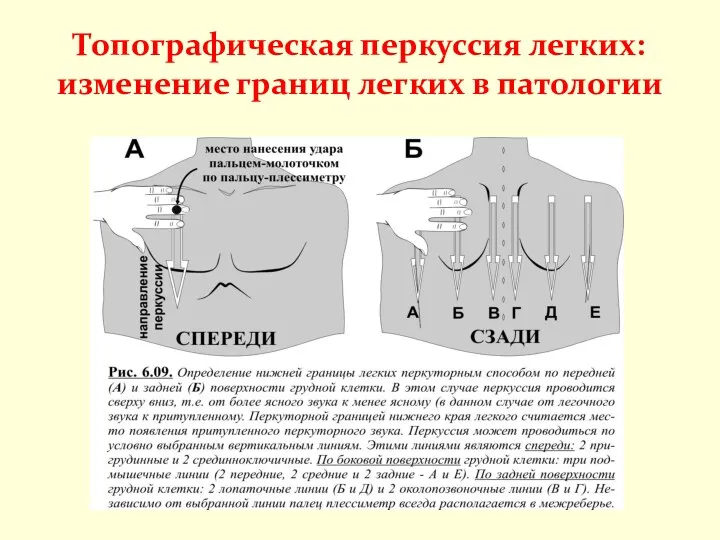 Топографическая перкуссия легких: изменение границ легких в патологии