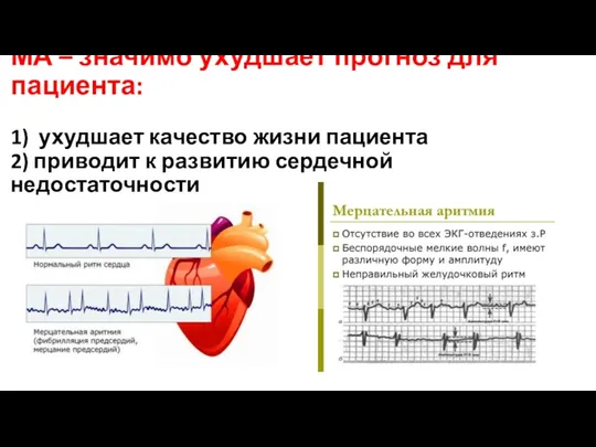 МА – значимо ухудшает прогноз для пациента: 1) ухудшает качество