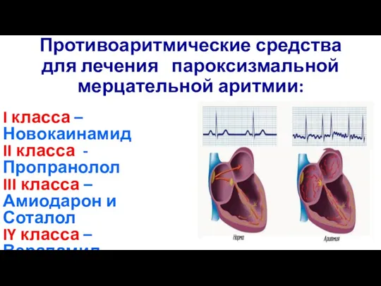 Противоаритмические средства для лечения пароксизмальной мерцательной аритмии: I класса –