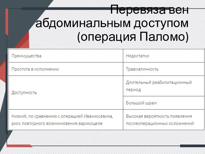 Перевяза вен абдоминальным доступом (операция Паломо)