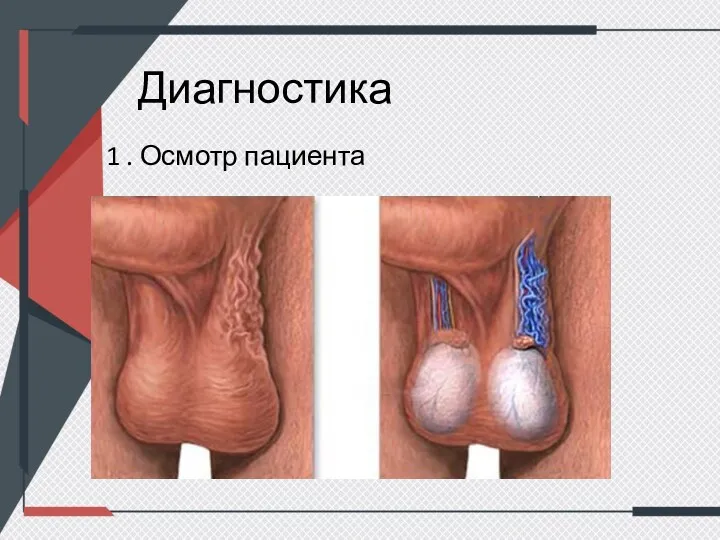 Диагностика 1 . Осмотр пациента