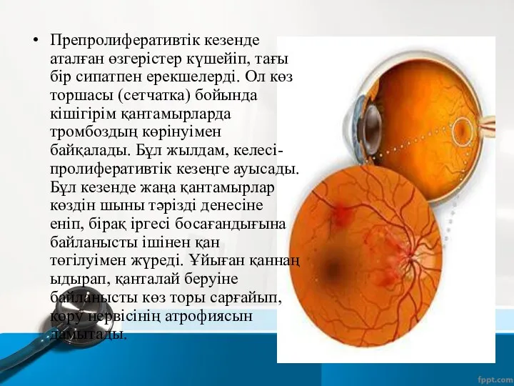 Препролиферативтік кезенде аталған өзгерістер күшейіп, тағы бір сипатпен ерекшелерді. Ол