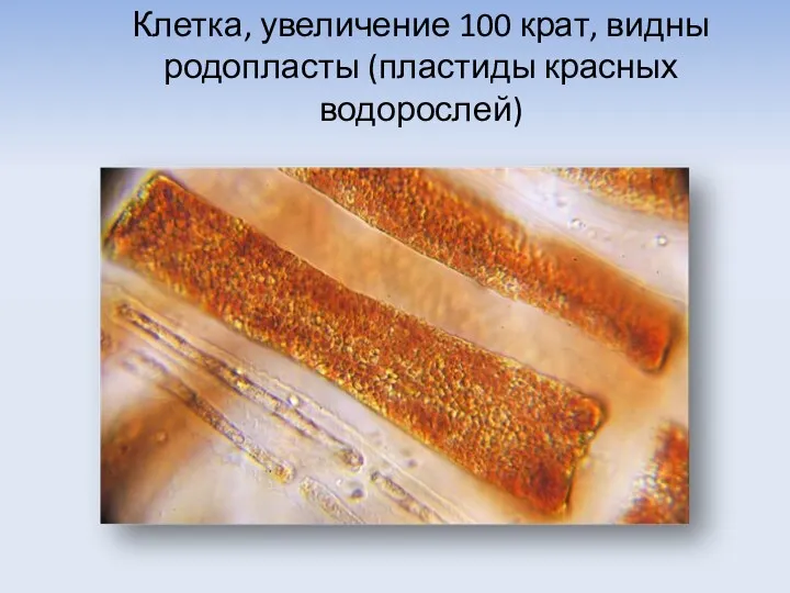 Клетка, увеличение 100 крат, видны родопласты (пластиды красных водорослей)