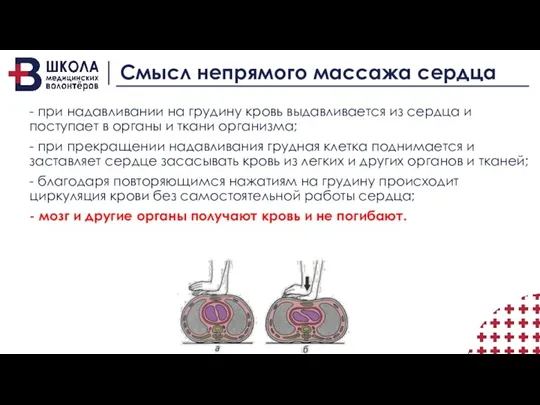 Смысл непрямого массажа сердца - при надавливании на грудину кровь