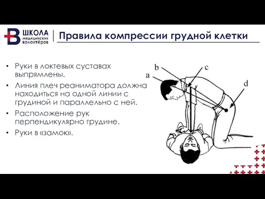 Правила компрессии грудной клетки Руки в локтевых суставах выпрямлены. Линия