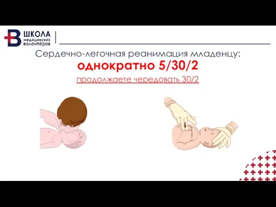 Сердечно-легочная реанимация младенцу: однократно 5/30/2 продолжаете чередовать 30/2