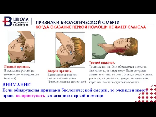 ПРИЗНАКИ БИОЛОГИЧЕСКОЙ СМЕРТИ КОГДА ОКАЗАНИЕ ПЕРВОЙ ПОМОЩИ НЕ ИМЕЕТ СМЫСЛА