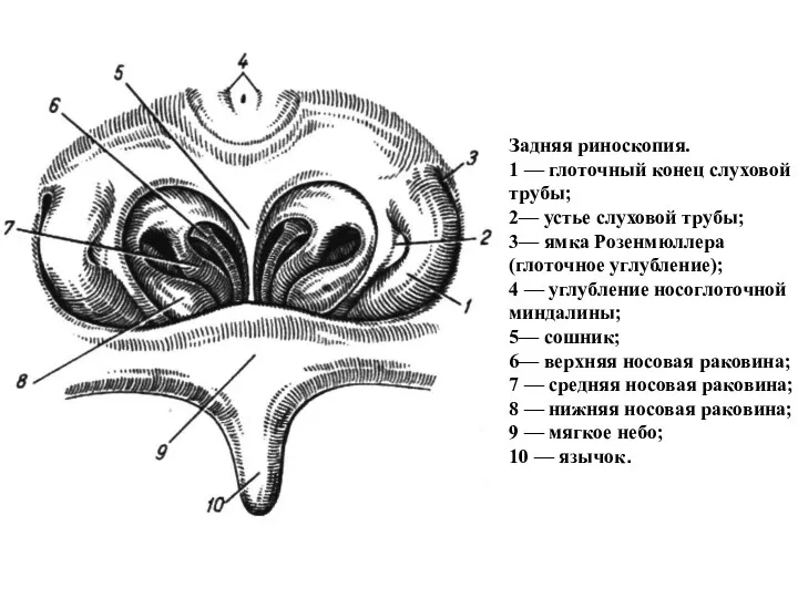Задняя риноскопия. 1 — глоточный конец слуховой трубы; 2— устье слуховой трубы; 3—